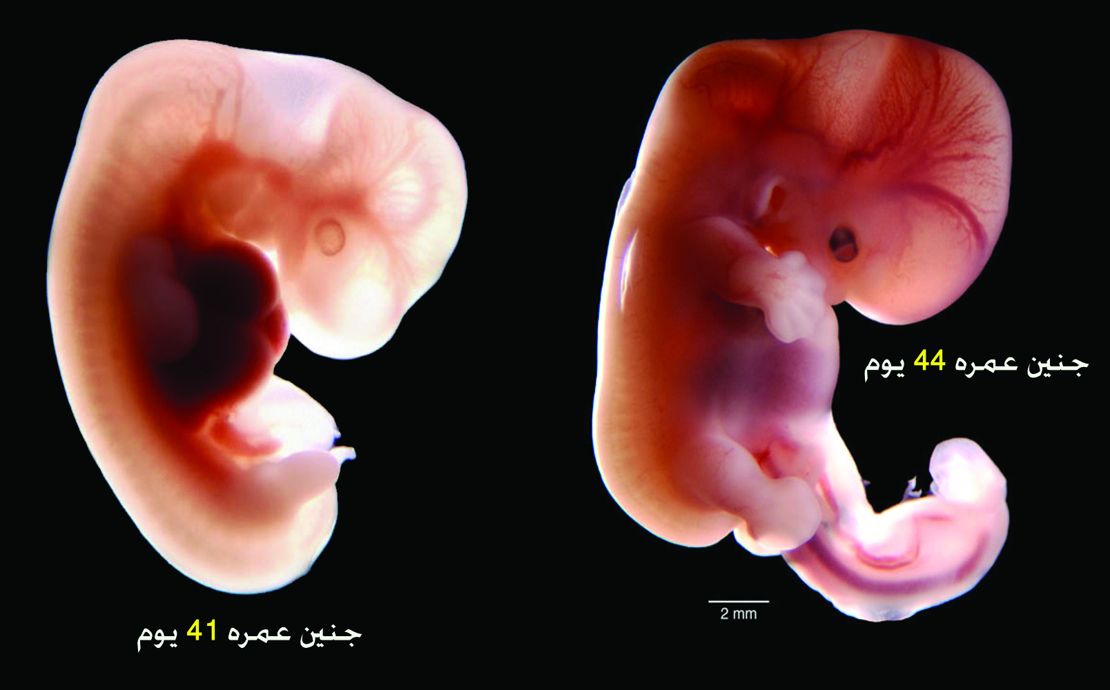 مراحل تكوين الجنين بالصور من اول يوم - اجمل صور مراحل تكوين الجنين 874 6