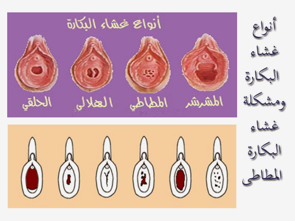 ما هي العذرية - ما المقصود بالعذرية 11809