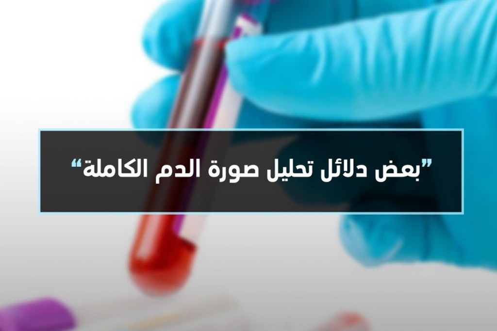 ما هو تحليل Ldh - تعرف على نازعة هيدروجين اللاكتات 11501 7