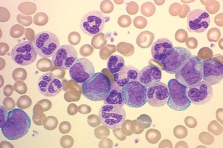 تعرف على ما هو neutrophils , ما هو neutrophils