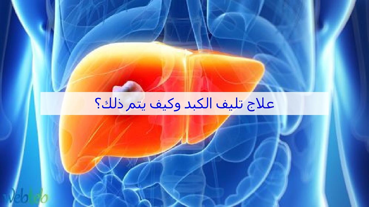 علاج تليف الكبد , احمي نفسك وعائلتك من تليف الكبد