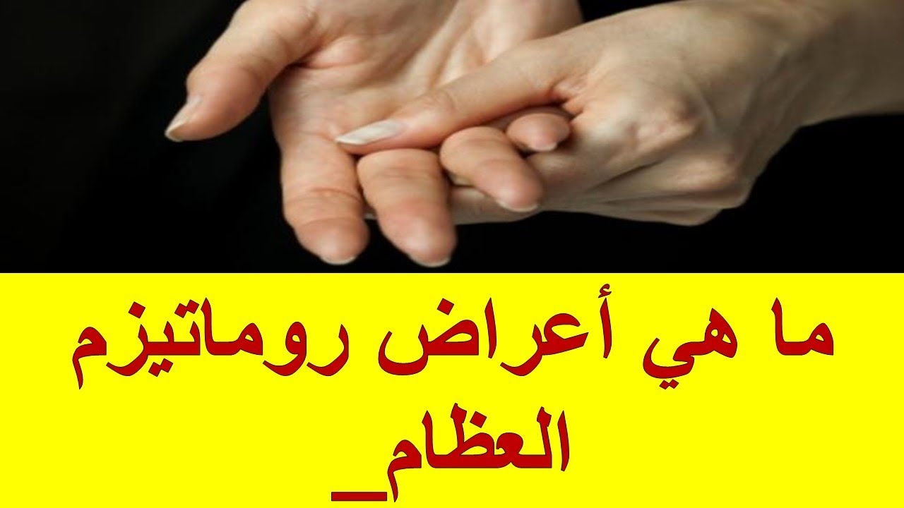 اعراض الروماتيزم , الالام المفاصل الدائم