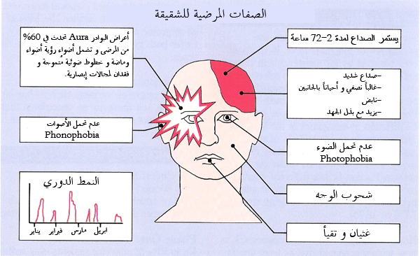 مرض الشقيقة 5404